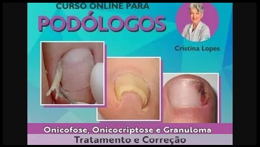 Curso Online para Podólogos